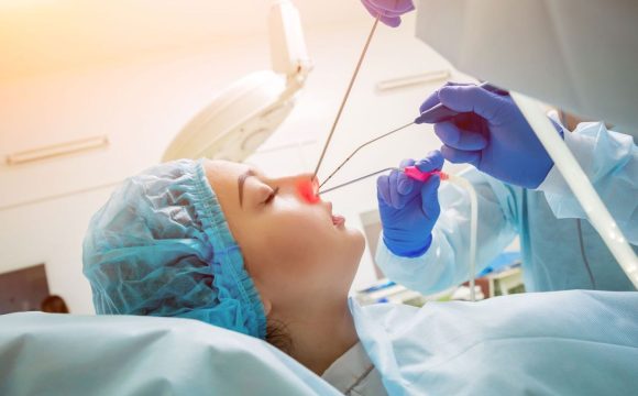 Лазерная вапоризация нижних носовых раковин